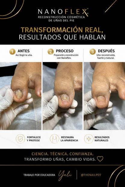 📍Bayamón, PR 🇵🇷  | NanoFlex + NanoBrace | Oct 4, 2026 | Presencial