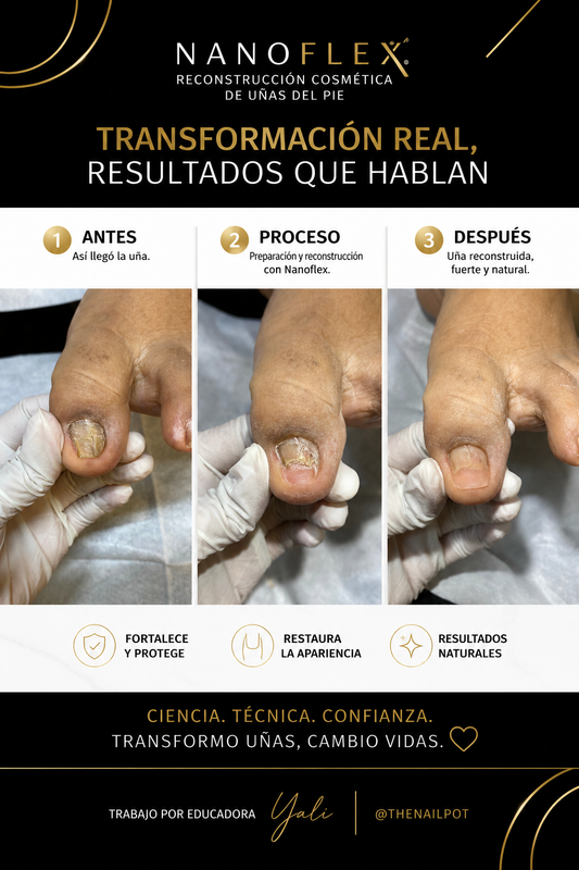 NanoFlex + NanoBrace Certificación NanoPro | En Vivo, En Línea | Varias Fechas | ESPAÑOL